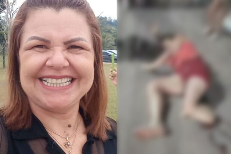 Mulher que teve perna decepada ao ser atropelada morre em hospital de Manaus