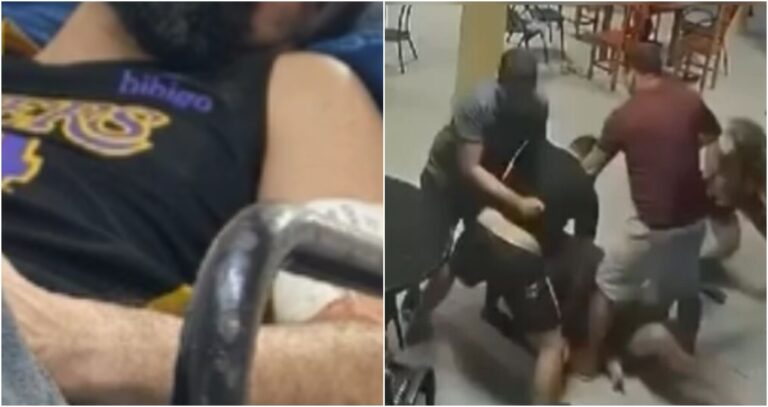 IMAGEM FORTE: Homem tem rosto desfigurado durante briga de condomínio em Manaus