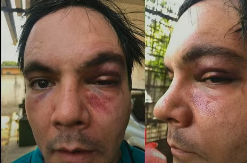 Caso Mateus: autista é espancado após ser confundido com ladrão em Manaus