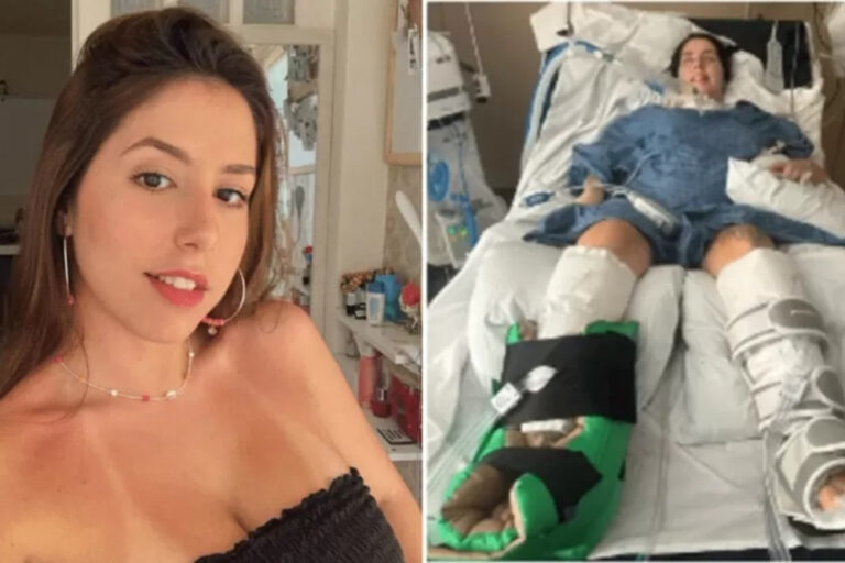 Brasileira fala sobre recuperação depois de ficar paralisada ao tomar sopa nos EUA: "Foi só uma colher"