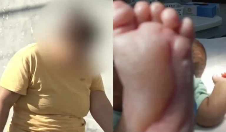 Mãe é presa por suspeita de queimar bebê de 6 meses com água quente em Cariacica