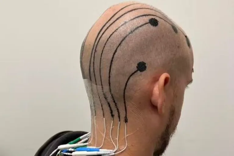 Novas “e-tattoos” captam a atividade cerebral no lugar de eletrodos; entenda
