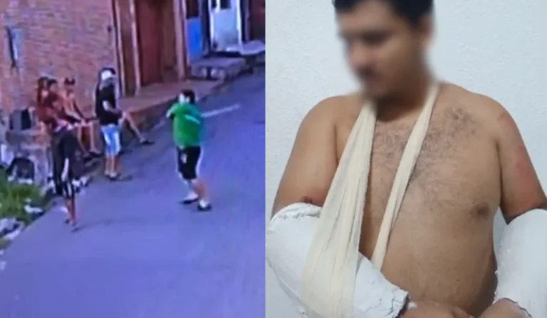 Homem teve os dois braços quebrados após agredir morador de rua. (FOTO: Reprodução)