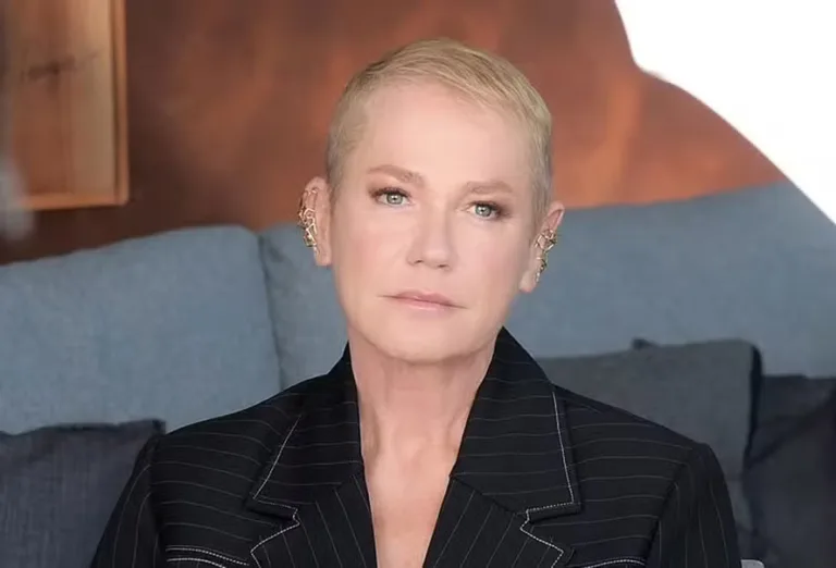 Xuxa diz que tem vontade de raspar cabeça devido à alopecia: Entenda a doença