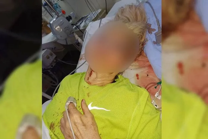 Idosa é agredida por morador de rua sob efeito de drogas em Brasília