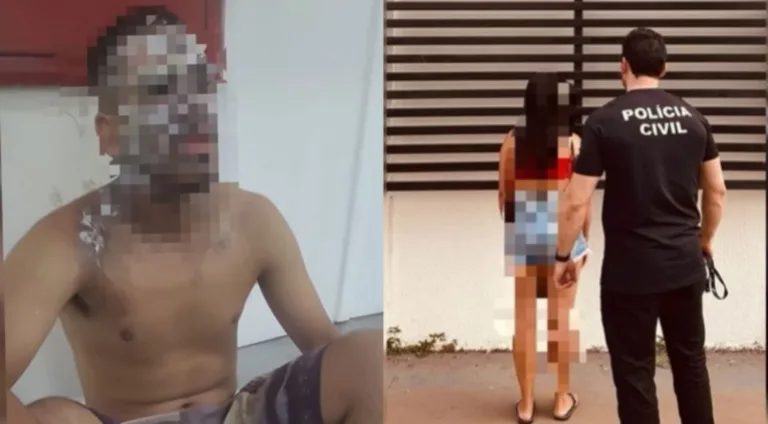 Após discussão, mulher joga água fervendo no rosto do marido em GO