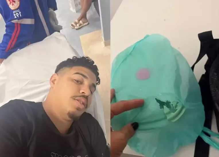 Barbeiro é salvo por marmita em tentativa de assalto: “quase fiquei paraplégico”