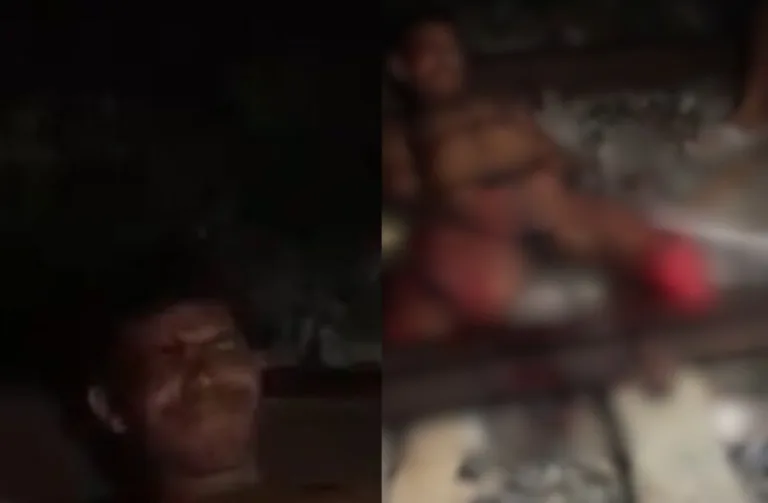 IMAGENS FORTES: Homem dorme em trilho e tem pernas esmagadas por trem em Natal
