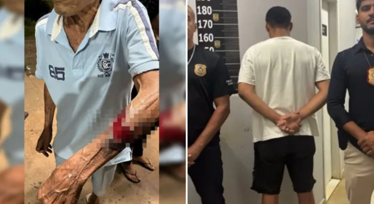 VÍDEO: Filho agride e arranca pedaço de pele do braço do pai idoso, no Distrito Federal