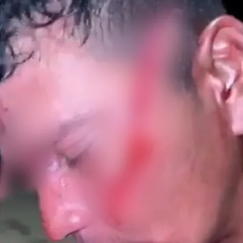 IMAGENS FORTES: Discussão entre casais termina em sangue e facadas no rosto no Amapá