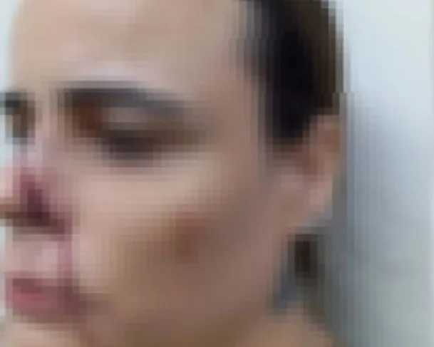 Mulher foi agredida por vizinho