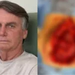 Bolsonaro-foto-intestino-redes-sociais