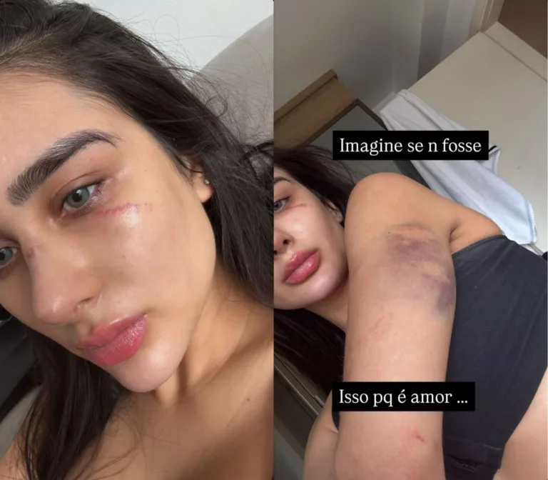 Miss Amazonas denuncia agressão do ex-namorado: “Me jogou no chão, me espancou”