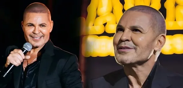 Eduardo Costa aparece de visual novo, é criticado e rebate: “Sabia que ia assustar”