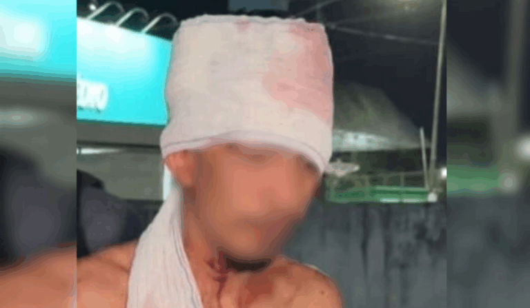Morador de rua é brutalmente espancado após invadir casa em Manaus