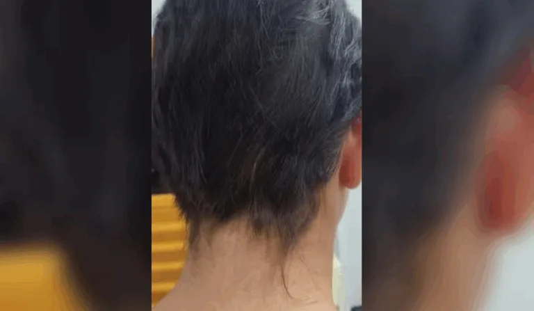 Mãe espanca e corta o cabelo da filha de 13 anos com faca em Manaus