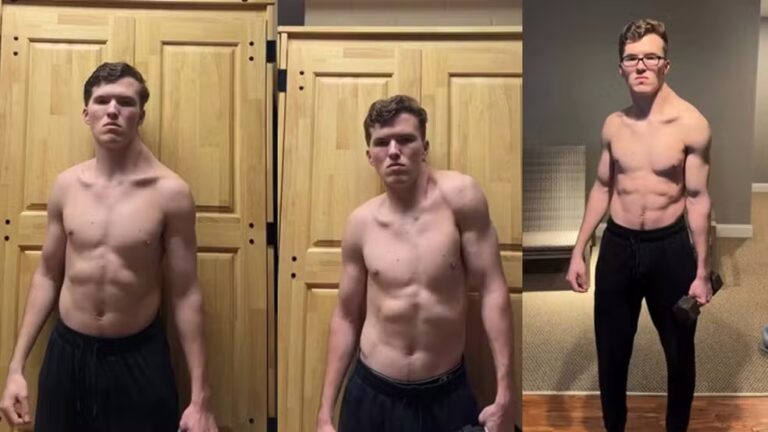 "Homem torto": Influencer treina somente um lado do trapézio e viraliza ao mostrar resultado