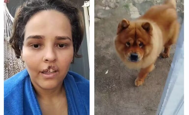 Cachorro arranca lábio de dona e marido manda matar animal