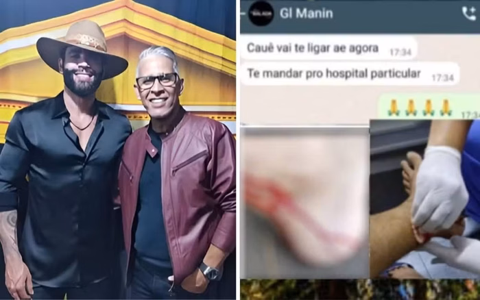 Irmão de Gusttavo Lima é mordido por macaco durante passeio em Goiânia e cantor reage: "É azarado"