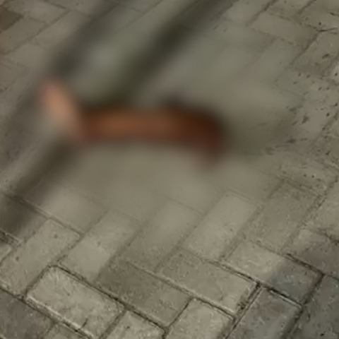 IMAGENS FORTES: motociclista perde a perna ao bater em poste em Caruaru