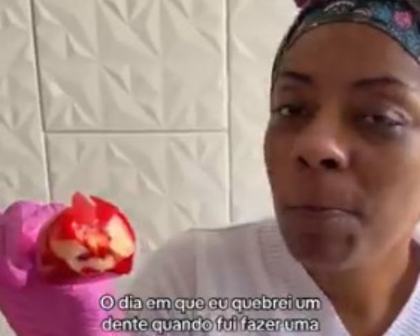 Confeiteira quebra dente enquanto faz propaganda de Morango do Amor