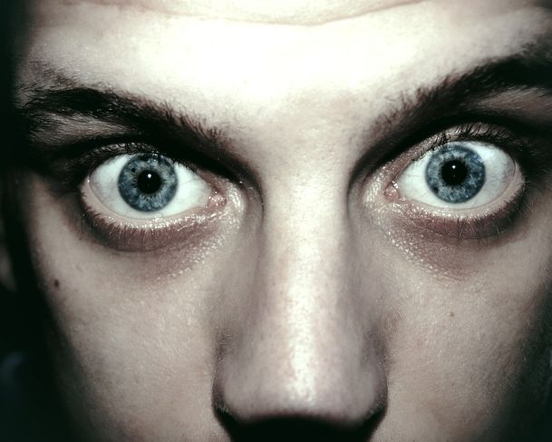 Conheça seis transtornos mentais mais raros e bizarros
