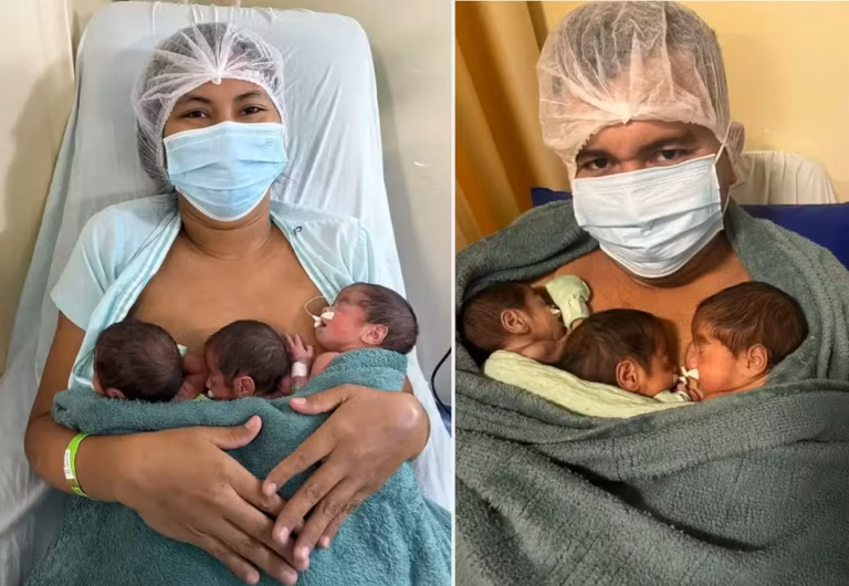 Mãe descobre gravidez de trigêmeos no momento do parto, no Pará
