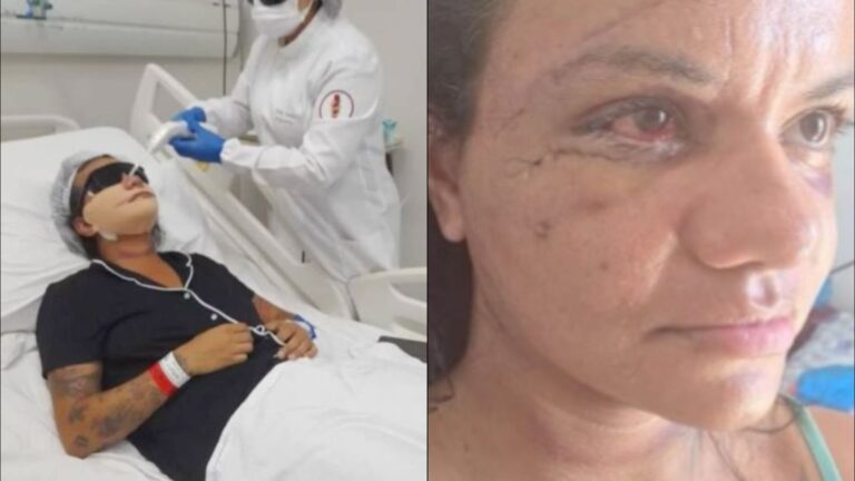 Mulher agredida por ex-jogador de basquete em elevador mostra rosto pela primeira vez após cirurgias; veja