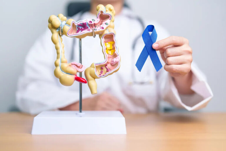 Câncer colorretal: Entenda sintomas e como diminuir o risco da doença