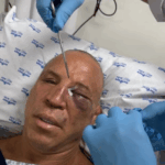 Wanderlei-Silva-Hospital