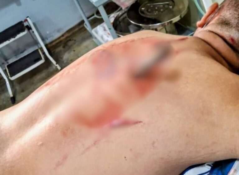 Homem tem faca cravada nas costas durante briga por ciúmes da ex no Amazonas