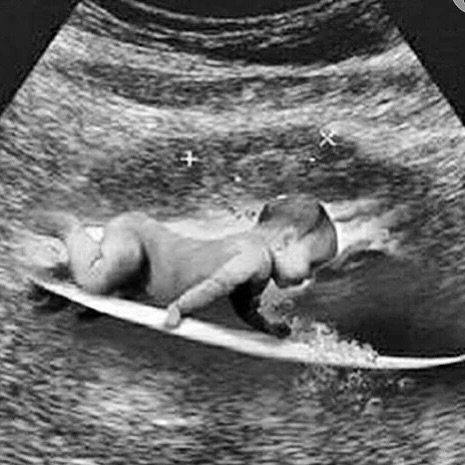 Com bebê na prancha, Gabriel Medina anuncia que vai ser pai Com bebê na prancha, Gabriel Medina anuncia que vai ser pai