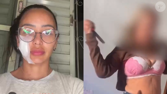 Ex-bailarina do Faustão é agredida com faca no rosto pela mãe Ex-bailarina do Faustão é agredida com faca no rosto pela mãe