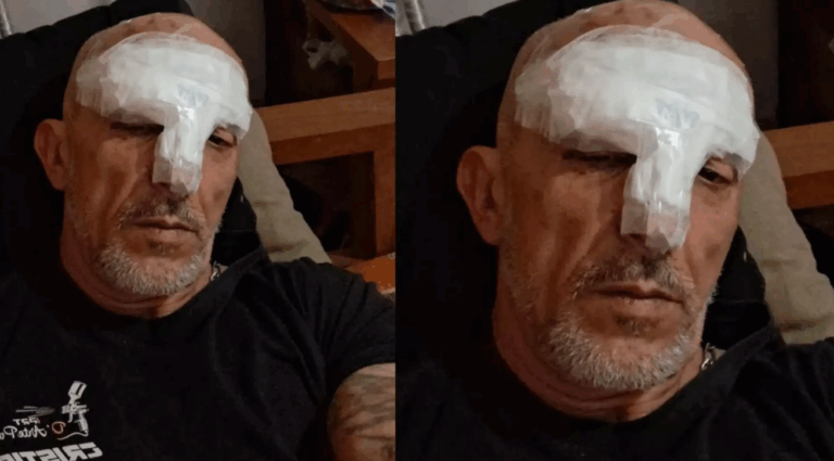 Cristian Cravinhos leva 15 pontos no rosto após acidente de moto em São Paulo