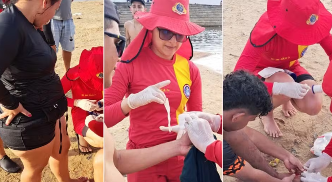 Novo ataque de piranhas deixa seis feridos em balneário de Manacapuru