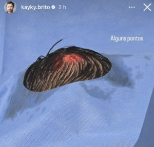 Foto: Reprodução/Instagram 