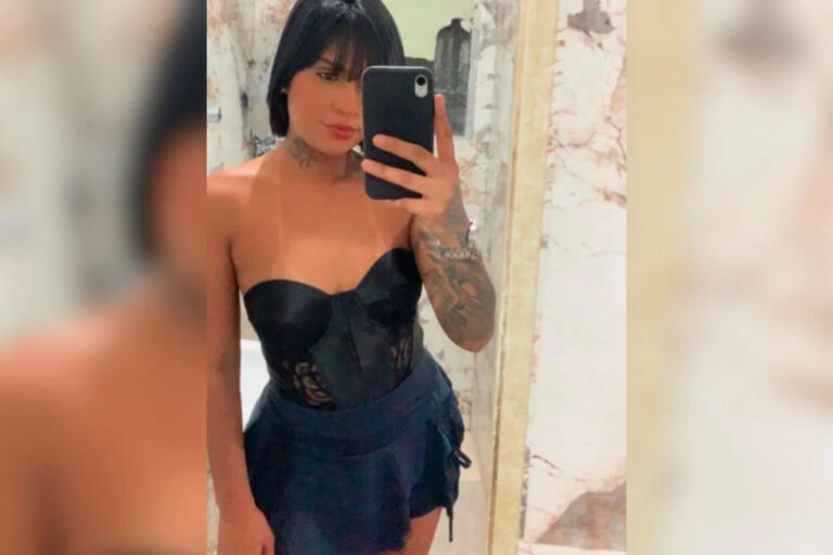 Mulher que perdeu as pernas ao ser arrastada em SP passa por uma nova cirurgia de amputação