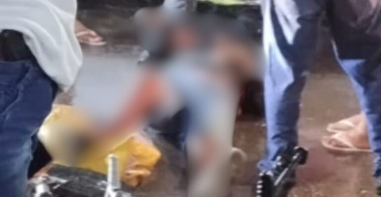 Motociclista quebra a perna após grave acidente na zona Norte de Manaus