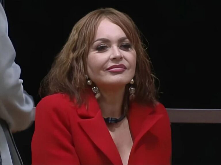 Gaby Spanic mostra resultado de harmonização facial e surpreende seguidores