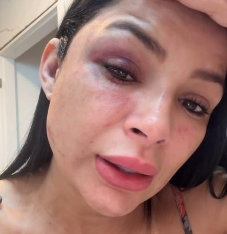 Musa de escola de samba denuncia motociclista de app por agressão em Manaus