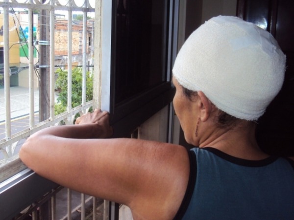 CAS aprova pensão especial para vítimas de escalpelamento e reforça alerta sobre tragédias na Amazônia