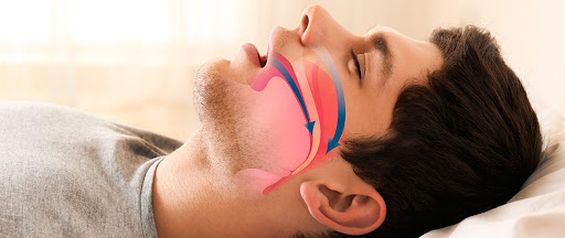 Respirar pela boca pode provocar problemas orais e até alterações na postura