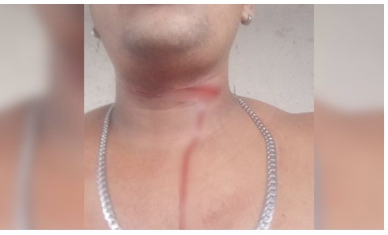 Jovem quase é degolado por linha de cerol em Manaus