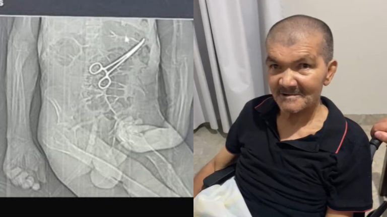 Idoso morre no Natal após ter pinça esquecida dentro do corpo, em MG