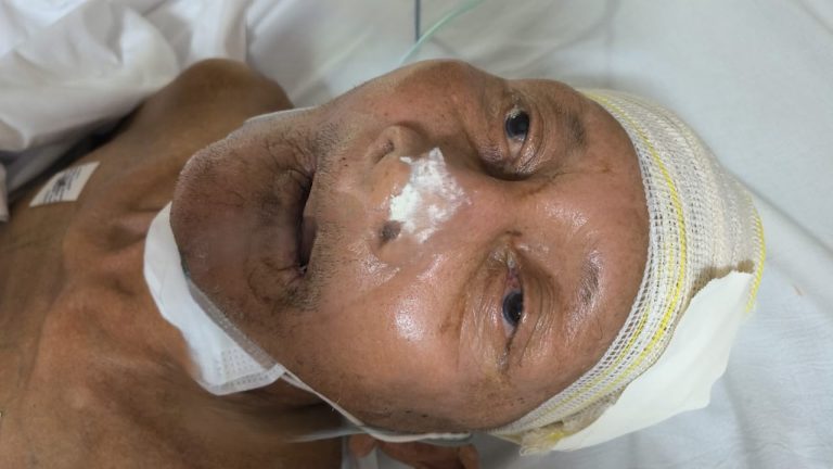 Hospital procura família de idoso internado após sofrer queda em Manaus