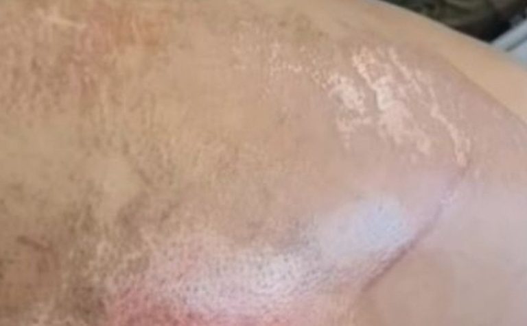 Homem atropela ex-mulher no momento que vítima descia de moto no Amazonas