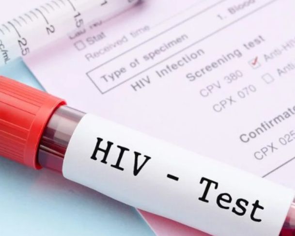 Injeção contra HIV será testada em estudo da Fiocruz