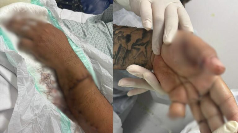 Motorista de app tem dedo decepado a terçadadas ao cobrar pagamento de passageiro em Manaus