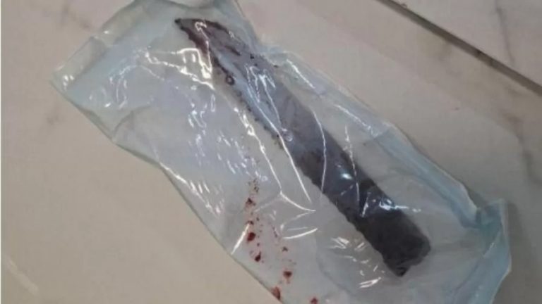 Mulher tem faca cravada no olho após companheiro tentar matá-la em Santa Catarina