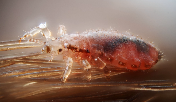 Fique atento: selfies e volta às aulas favorecem infestação de piolhos em crianças